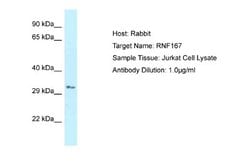 RNF167 Rabbit anti-Human, Polyclonal, Novus Biologicals 0.1 mL | Buy Online | Novus Biologicals | Fisher Scientific